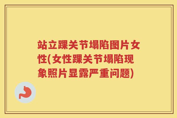 站立踝关节塌陷图片女性(女性踝关节塌陷现象照片显露严重问题)