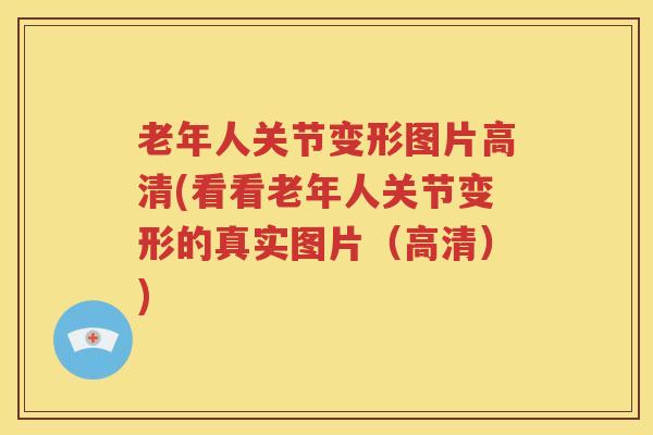 老年人关节变形图片高清(看看老年人关节变形的真实图片(高清)) 老年人关节变形图片高清(看看老年人关节变形的真实图片(高清))