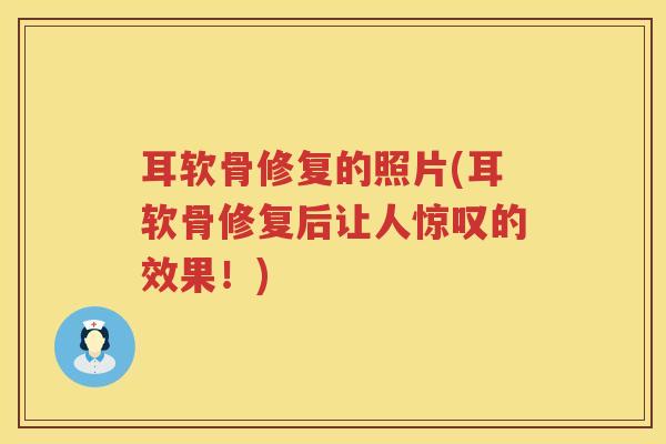 耳软骨修复的照片(耳软骨修复后让人惊叹的效果!) 耳软骨修复的照片(耳软骨修复后让人惊叹的效果!)