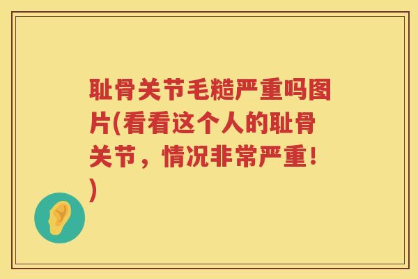 耻骨关节毛糙严重吗图片(看看这个人的耻骨关节,情况非常严重!) 耻骨关节毛糙严重吗图片(看看这个人的耻骨关节,情况非常严重!)