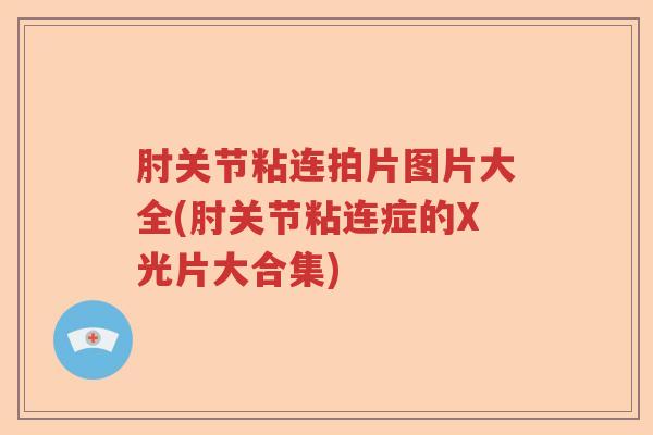 肘关节粘连拍片图片大全(肘关节粘连症的X光片大合集) 肘关节粘连拍片图片大全(肘关节粘连症的X光片大合集)
