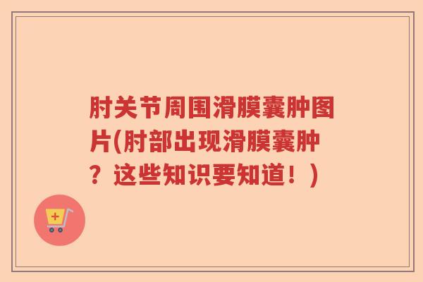 肘关节周围滑膜囊肿图片(肘部出现滑膜囊肿？这些知识要知道！)