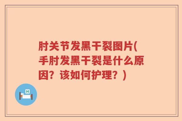肘关节发黑干裂图片(手肘发黑干裂是什么原因？该如何护理？)