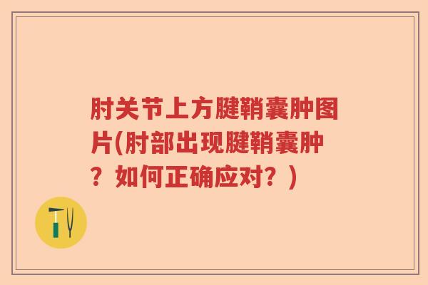 肘关节上方腱鞘囊肿图片(肘部出现腱鞘囊肿？如何正确应对？)