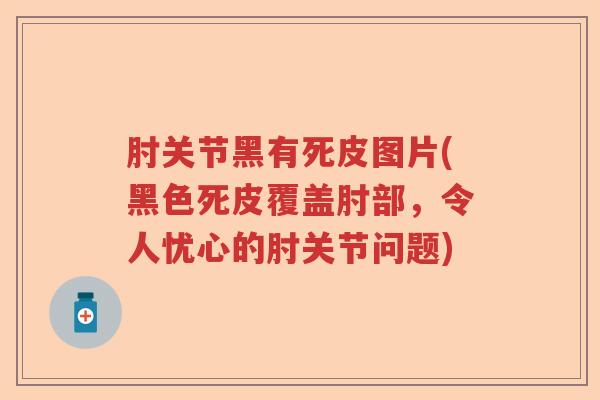 肘关节黑有死皮图片(黑色死皮覆盖肘部，令人忧心的肘关节问题)