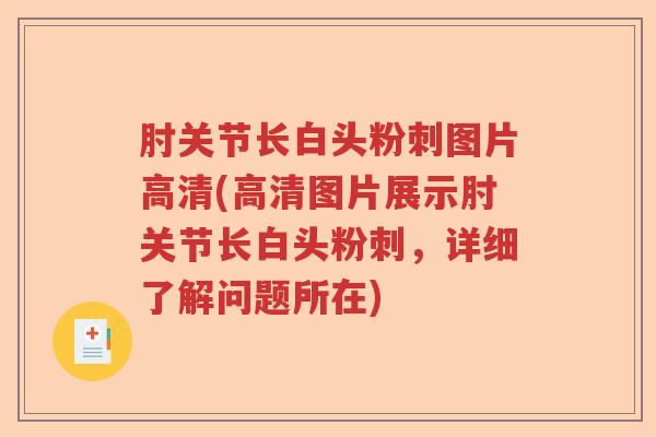 肘关节长白头粉刺图片高清(高清图片展示肘关节长白头粉刺,详细了解问题所在) 肘关节长白头粉刺图片高清(高清图片展示肘关节长白头粉刺,详细了解问题所在)