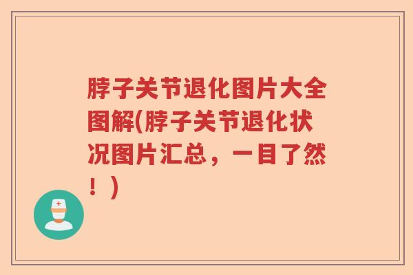 脖子关节退化图片大全图解(脖子关节退化状况图片汇总,一目了然!) 脖子关节退化图片大全图解(脖子关节退化状况图片汇总,一目了然!)