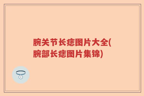 腕关节长痣图片大全(腕部长痣图片集锦) 腕关节长痣图片大全(腕部长痣图片集锦)