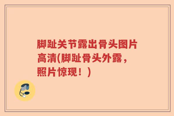 脚趾关节露出骨头图片高清(脚趾骨头外露，照片惊现！)