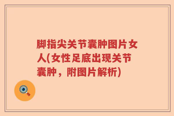 脚指尖关节囊肿图片女人(女性足底出现关节囊肿，附图片解析)