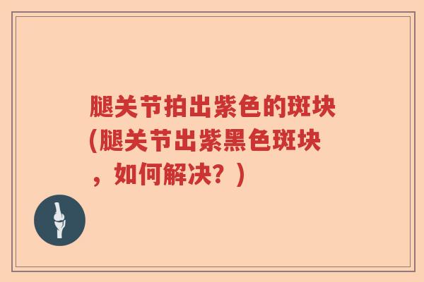 腿关节拍出紫色的斑块(腿关节出紫黑色斑块,如何解决?) 腿关节拍出紫色的斑块(腿关节出紫黑色斑块,如何解决?)