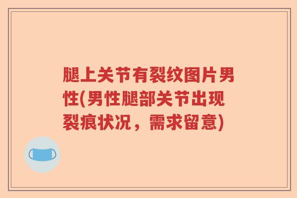 腿上关节有裂纹图片男性(男性腿部关节出现裂痕状况,需求留意) 腿上关节有裂纹图片男性(男性腿部关节出现裂痕状况,需求留意)
