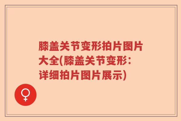 膝盖关节变形拍片图片大全(膝盖关节变形:详细拍片图片展示) 膝盖关节变形拍片图片大全(膝盖关节变形:详细拍片图片展示)