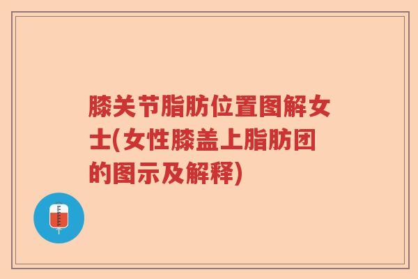 膝关节脂肪位置图解女士(女性膝盖上脂肪团的图示及解释) 膝关节脂肪位置图解女士(女性膝盖上脂肪团的图示及解释)