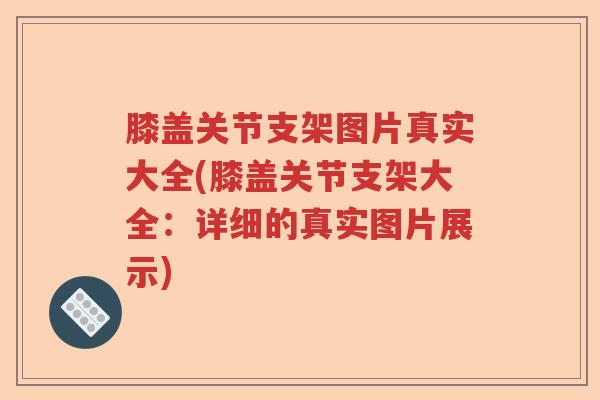 膝盖关节支架图片真实大全(膝盖关节支架大全:详细的真实图片展示) 膝盖关节支架图片真实大全(膝盖关节支架大全:详细的真实图片展示)