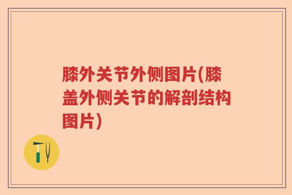 膝外关节外侧图片(膝盖外侧关节的解剖结构图片) 膝外关节外侧图片(膝盖外侧关节的解剖结构图片)