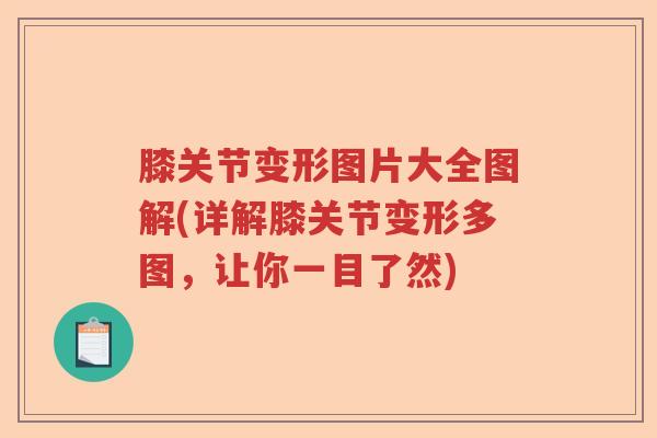 膝关节变形图片大全图解(详解膝关节变形多图，让你一目了然)