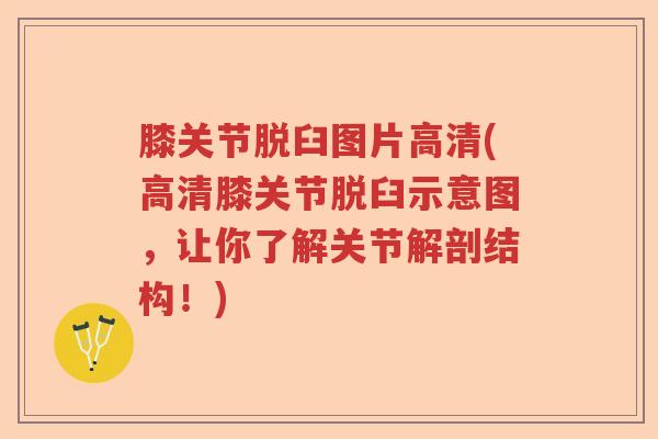 膝关节脱臼图片高清(高清膝关节脱臼示意图,让你了解关节解剖结构!) 膝关节脱臼图片高清(高清膝关节脱臼示意图,让你了解关节解剖结构!)