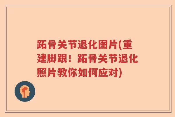 跖骨关节退化图片(重建脚跟!跖骨关节退化照片教你如何应对) 跖骨关节退化图片(重建脚跟!跖骨关节退化照片教你如何应对)