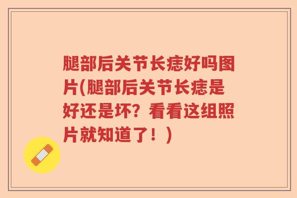 腿部后关节长痣好吗图片(腿部后关节长痣是好还是坏?看看这组照片就知道了!) 腿部后关节长痣好吗图片(腿部后关节长痣是好还是坏?看看这组照片就知道了!)