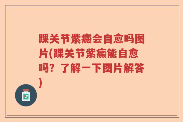 踝关节紫癜会自愈吗图片(踝关节紫癜能自愈吗?了解一下图片解答) 踝关节紫癜会自愈吗图片(踝关节紫癜能自愈吗?了解一下图片解答)
