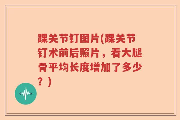 踝关节钉图片(踝关节钉术前后照片,看大腿骨平均长度增加了多少?) 踝关节钉图片(踝关节钉术前后照片,看大腿骨平均长度增加了多少?)