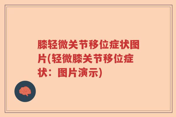 膝轻微关节移位症状图片(轻微膝关节移位症状:图片演示) 膝轻微关节移位症状图片(轻微膝关节移位症状:图片演示)