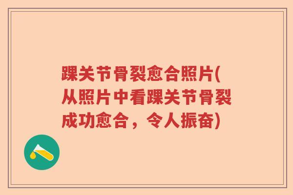 踝关节骨裂愈合照片(从照片中看踝关节骨裂成功愈合,令人振奋) 踝关节骨裂愈合照片(从照片中看踝关节骨裂成功愈合,令人振奋)