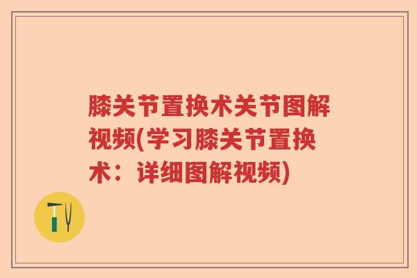 膝关节置换术关节图解视频(学习膝关节置换术：详细图解视频)
