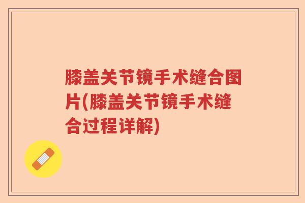 膝盖关节镜手术缝合图片(膝盖关节镜手术缝合过程详解)